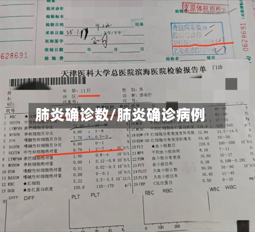 肺炎确诊数/肺炎确诊病例