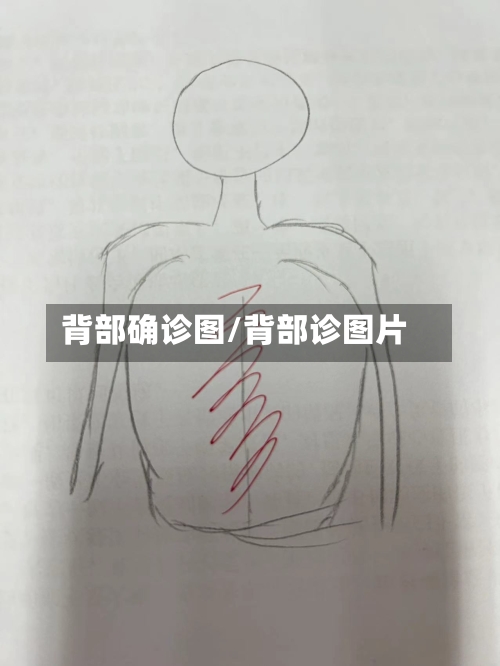 背部确诊图/背部诊图片-第3张图片