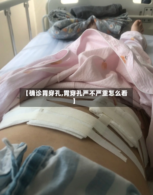 【确诊胃穿孔,胃穿孔严不严重怎么看】-第2张图片