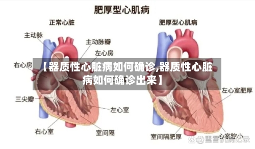 【器质性心脏病如何确诊,器质性心脏病如何确诊出来】