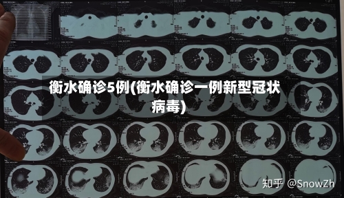衡水确诊5例(衡水确诊一例新型冠状病毒)-第2张图片