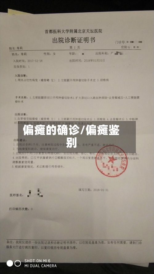偏瘫的确诊/偏瘫鉴别-第3张图片