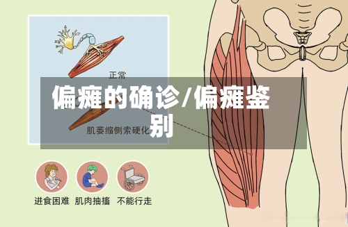 偏瘫的确诊/偏瘫鉴别