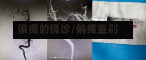 偏瘫的确诊/偏瘫鉴别-第2张图片