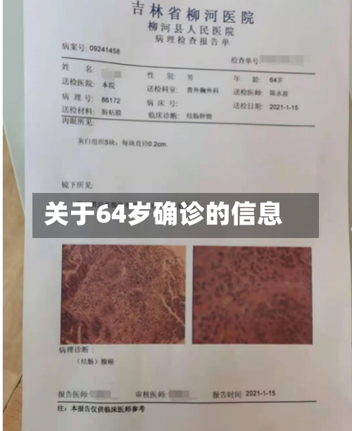 关于64岁确诊的信息-第2张图片