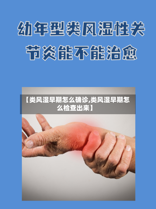 【类风湿早期怎么确诊,类风湿早期怎么检查出来】-第2张图片