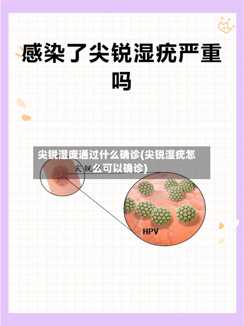尖锐湿庞通过什么确诊(尖锐湿疣怎么可以确诊)