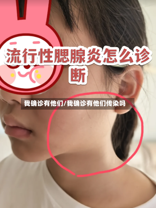 我确诊有他们/我确诊有他们传染吗