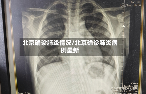 北京确诊肺炎情况/北京确诊肺炎病例最新