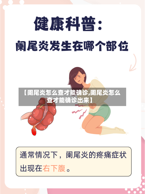 【阑尾炎怎么查才能确诊,阑尾炎怎么查才能确诊出来】