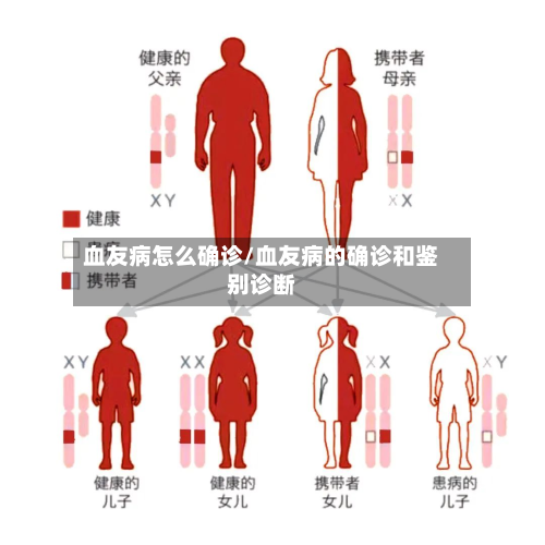 血友病怎么确诊/血友病的确诊和鉴别诊断