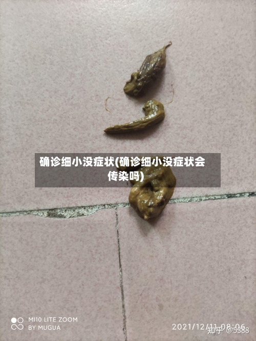 确诊细小没症状(确诊细小没症状会传染吗)-第3张图片