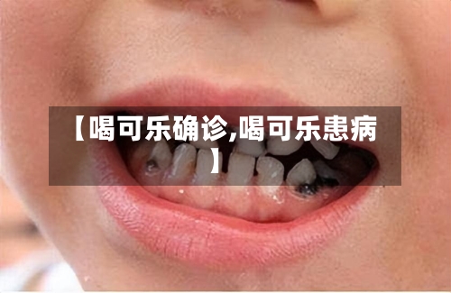 【喝可乐确诊,喝可乐患病】-第2张图片