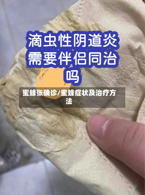 蜜蜂张确诊/蜜蜂症状及治疗方法-第2张图片