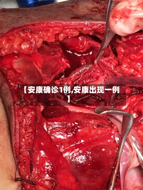 【安康确诊1例,安康出现一例】