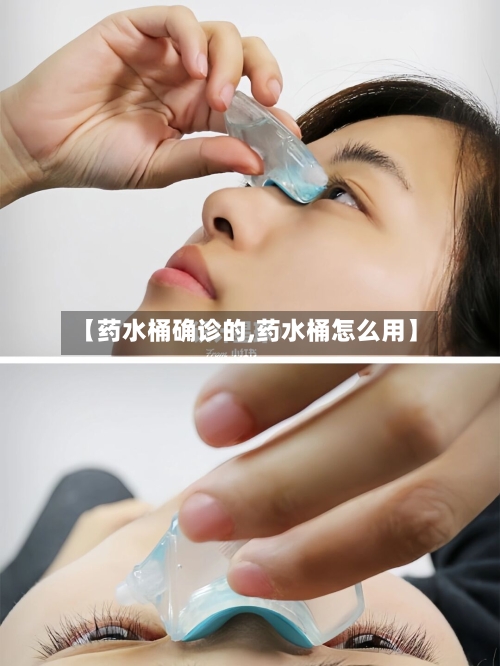 【药水桶确诊的,药水桶怎么用】-第2张图片