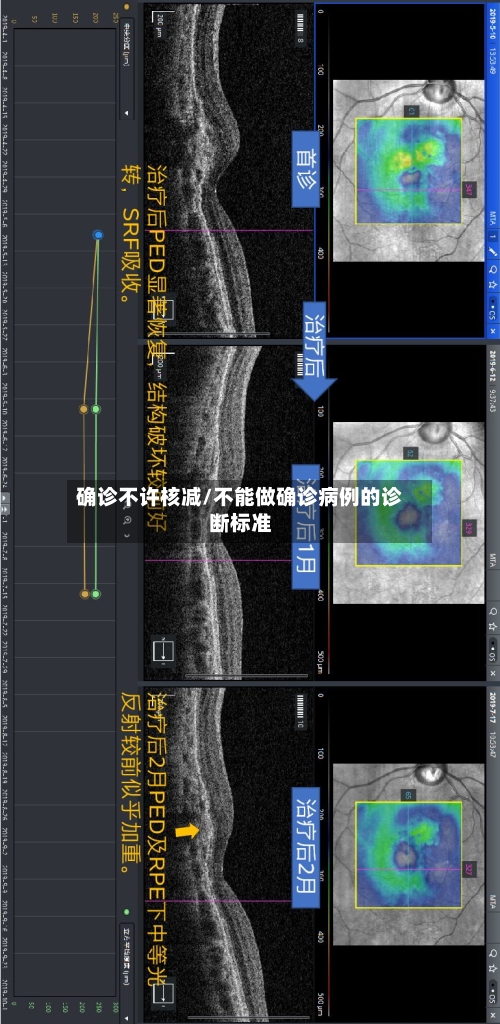 确诊不许核减/不能做确诊病例的诊断标准