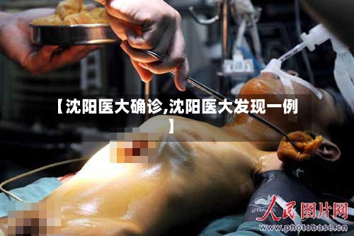 【沈阳医大确诊,沈阳医大发现一例】
