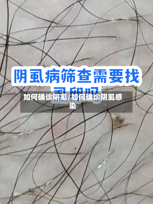 如何确诊阴虱/如何确诊阴虱感染-第2张图片