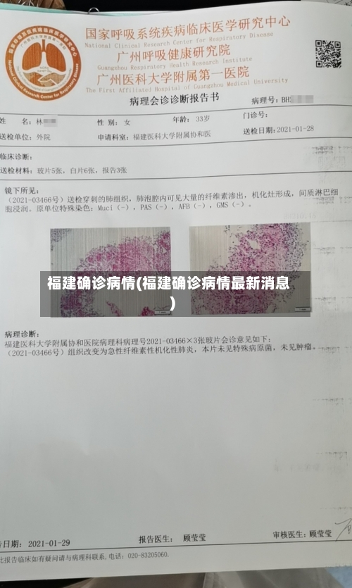 福建确诊病情(福建确诊病情最新消息)-第3张图片