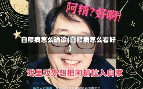 白颠疯怎么确诊(白颠疯怎么看好)