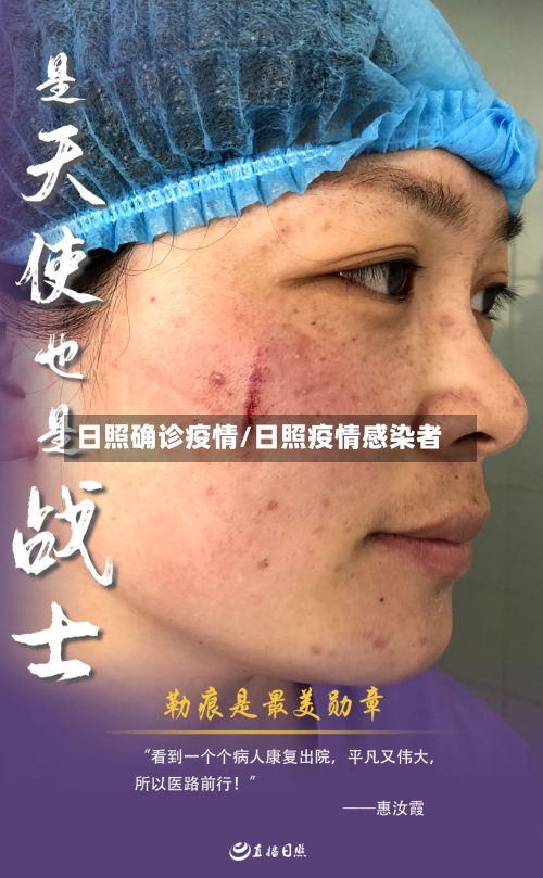 日照确诊疫情/日照疫情感染者