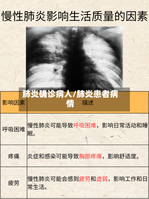 肺炎确诊病人/肺炎患者病情