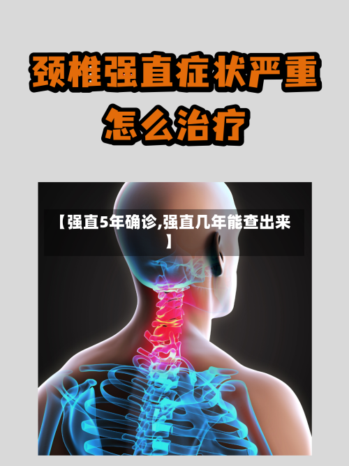 【强直5年确诊,强直几年能查出来】