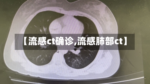 【流感ct确诊,流感肺部ct】