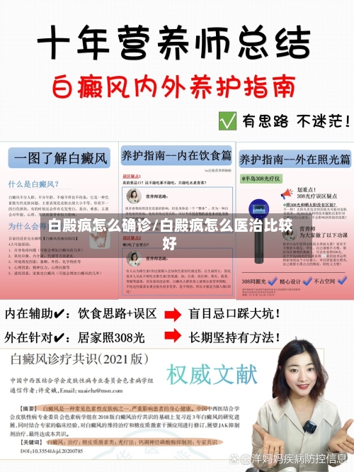 白殿疯怎么确诊/白殿疯怎么医治比较好-第2张图片