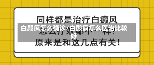 白殿疯怎么确诊/白殿疯怎么医治比较好