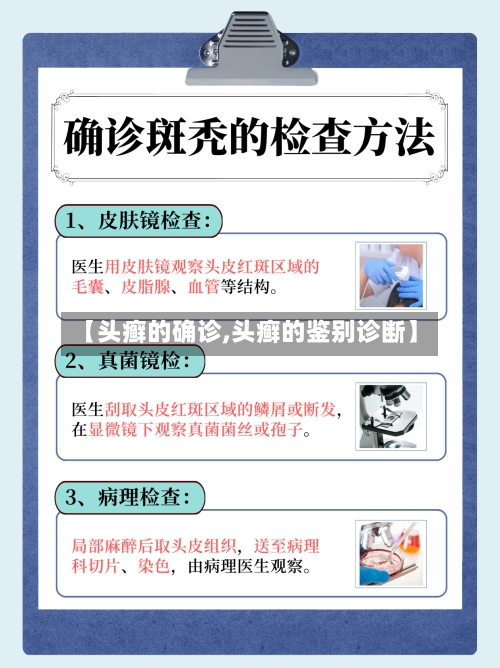 【头癣的确诊,头癣的鉴别诊断】-第2张图片