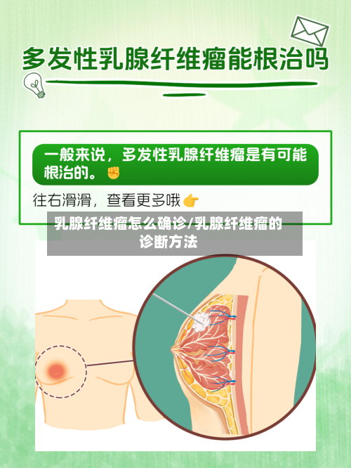 乳腺纤维瘤怎么确诊/乳腺纤维瘤的诊断方法