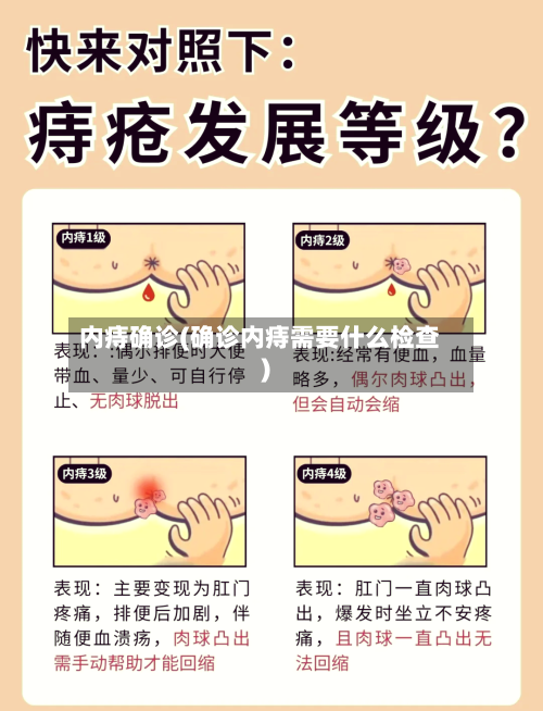 内痔确诊(确诊内痔需要什么检查)-第3张图片