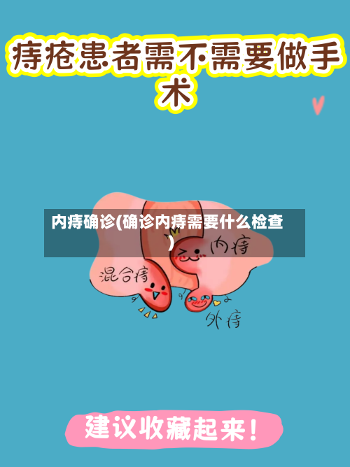 内痔确诊(确诊内痔需要什么检查)