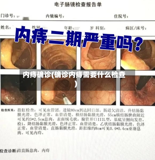 内痔确诊(确诊内痔需要什么检查)-第2张图片