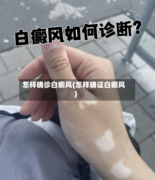怎样确诊白癜风(怎样确证白癜风)-第2张图片