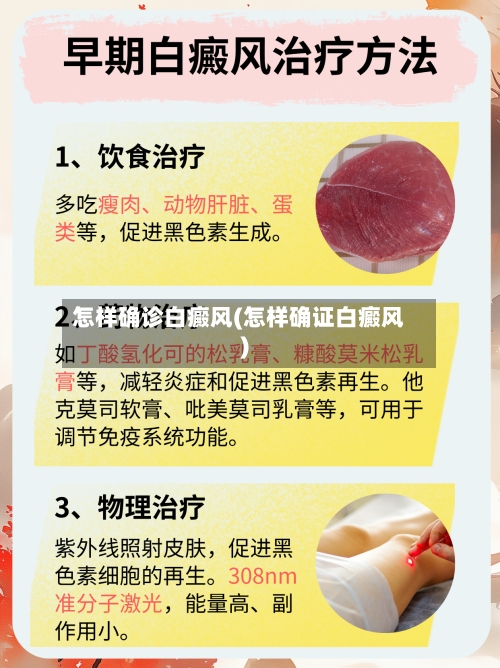 怎样确诊白癜风(怎样确证白癜风)-第3张图片