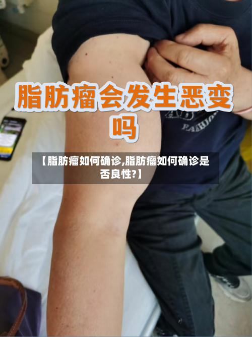 【脂肪瘤如何确诊,脂肪瘤如何确诊是否良性?】