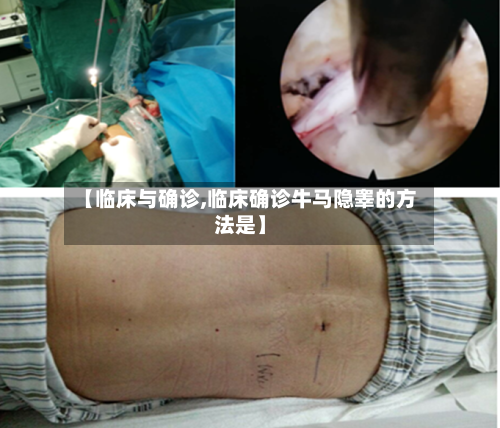 【临床与确诊,临床确诊牛马隐睾的方法是】
