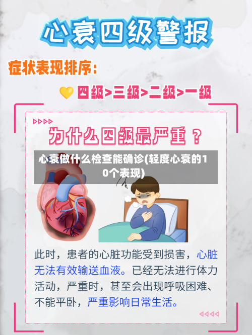 心衰做什么检查能确诊(轻度心衰的10个表现)-第2张图片