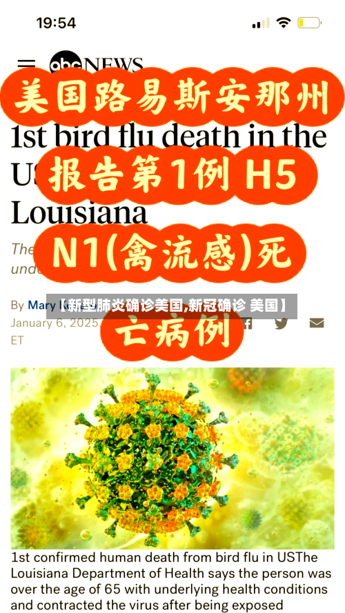 【新型肺炎确诊美国,新冠确诊 美国】-第2张图片