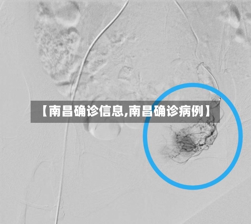 【南昌确诊信息,南昌确诊病例】