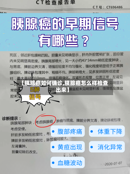 【胰腺癌如何确诊,胰腺癌怎么样检查出来】