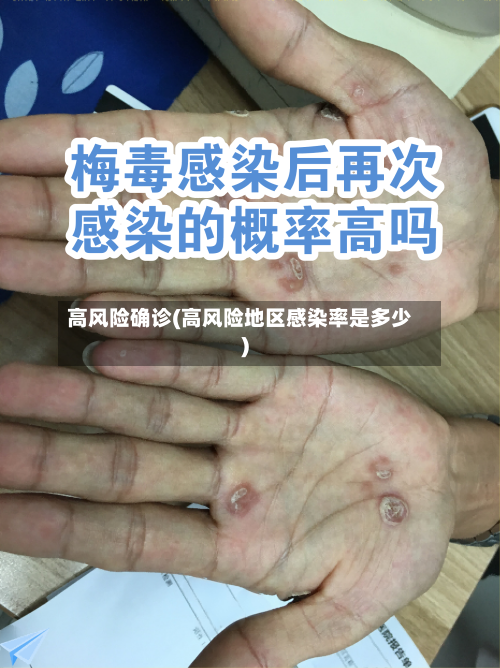 高风险确诊(高风险地区感染率是多少)-第3张图片