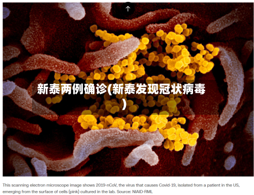 新泰两例确诊(新泰发现冠状病毒)-第2张图片
