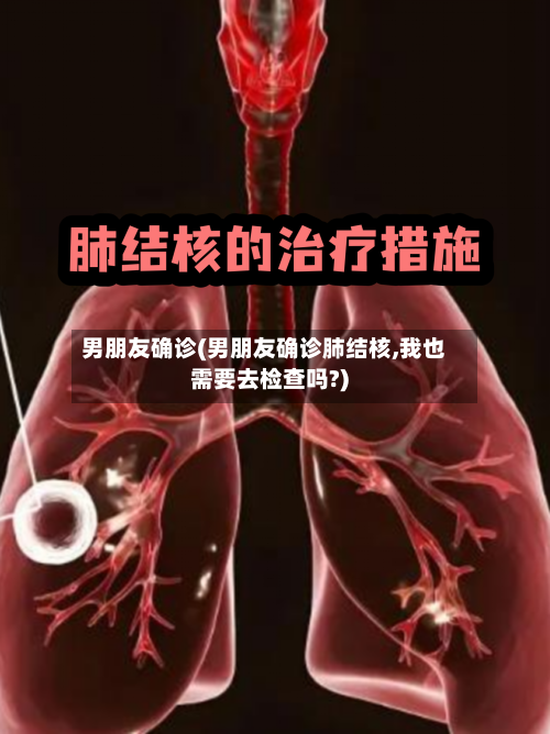 男朋友确诊(男朋友确诊肺结核,我也需要去检查吗?)-第3张图片