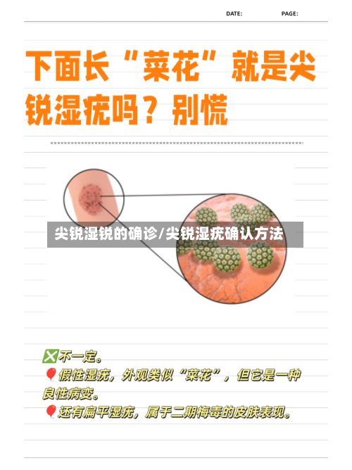 尖锐湿锐的确诊/尖锐湿疣确认方法