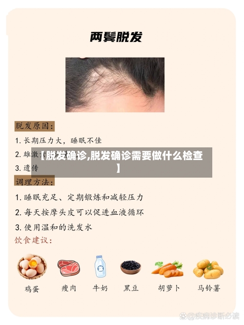 【脱发确诊,脱发确诊需要做什么检查】