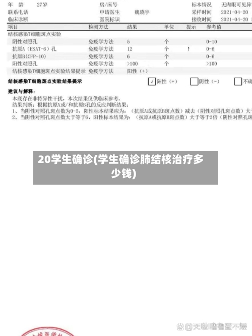 20学生确诊(学生确诊肺结核治疗多少钱)-第2张图片